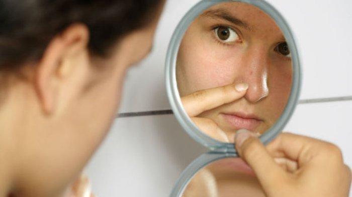 Cara Menghilangkan Komedo - Uapi Wajah, Pakai Tabir Surya hingga Clay Mask