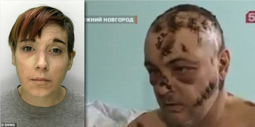 Inilah Efek Krokodil Obat yang Efeknya Lebih Kuat dari Heroin, Daging Membusuk & Komplikasi Penyakit