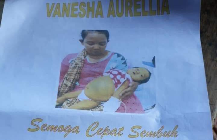 Bocah 11 Bulan di Sarolangun Menderita Penyakit Aneh, Kondisinya Melemah Karena Tak Ada Biaya