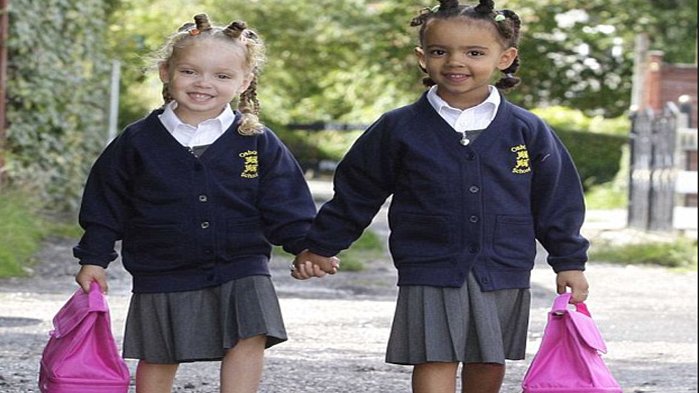 Unik, Kembar Tapi Beda! Tak Banyak yang Tahu, Ternyata Mereka Kembar Tidak Identik