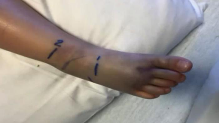 Hendak Memanen Singkong di Kebun, Warga Kampung Nagrak Ini Tewas Digigit Ular Berbisa