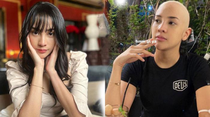 Heboh! Anya Geraldine Tampil Botak : Semoga Ini Pilihan Yang Tepat!