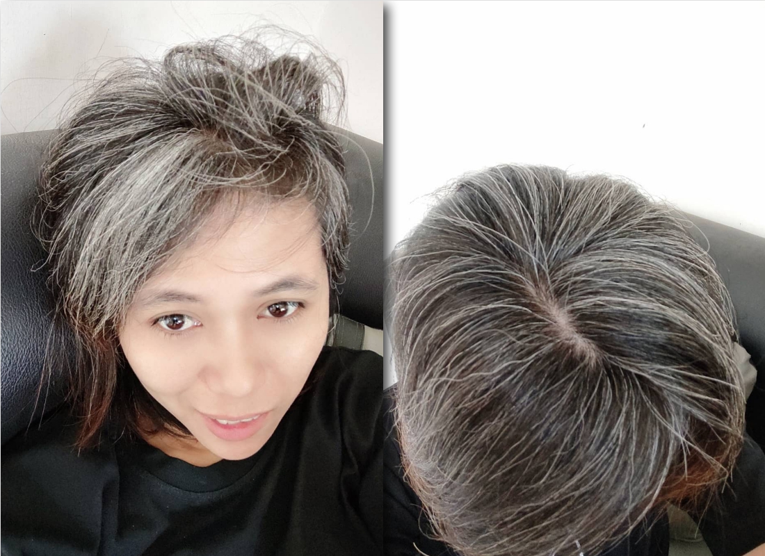 Stres hingga Rokok, Ini Penyebab Rambut Beruban di Usia Muda hingga Pencegahannya!