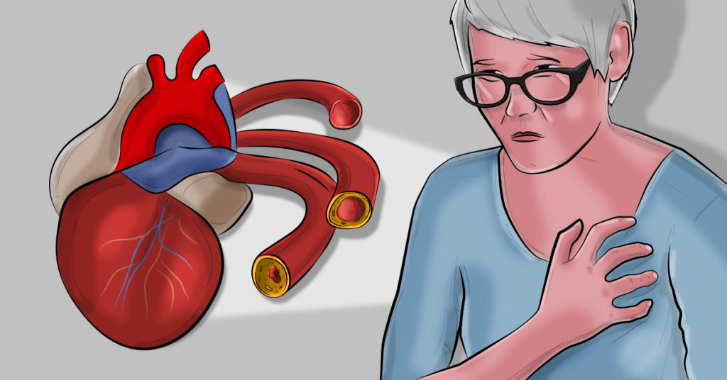 Warga Minta RSUD Raden Mataher Bisa Layani Bypass Jantung