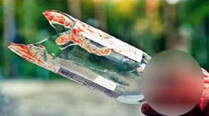 Istri Sadis, Tikam Suami Pakai Botol Kaca yang Dipecahkan. Alasannya Tak Diduga Cuma Karena