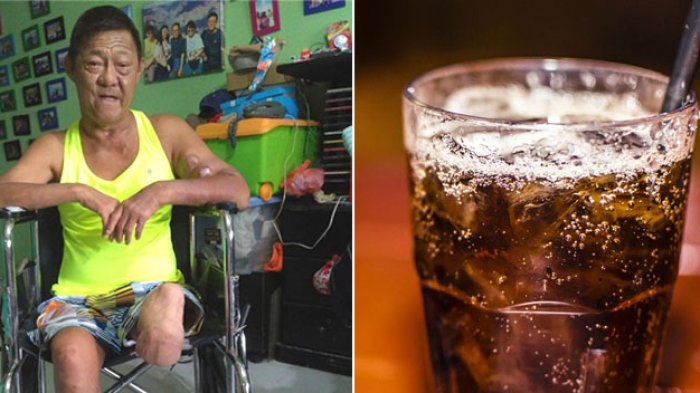 Minum 6 Kaleng Soda Tiap Hari, Pria Ini Kena Diabetes saat Usia 21