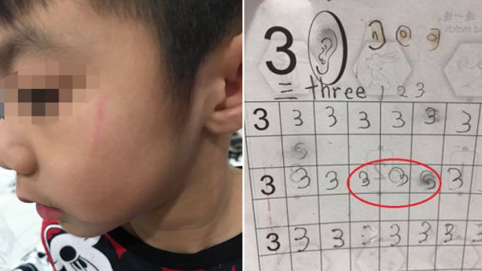 Tak Bisa Tulis Angka '3' dengan Benar, Seorang Murid Diduga Dipukuli Guru