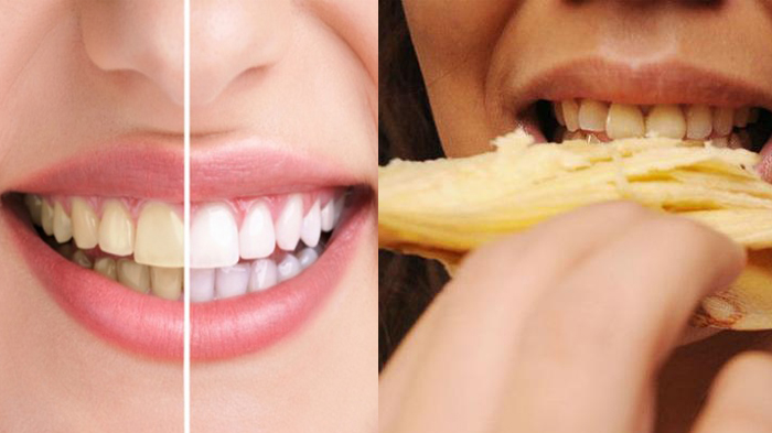 30102017-putihkan-gigi-dengan-kulit-pisang_20171030_230046.jpg