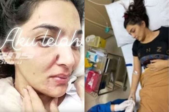 Perubahan Mendadak Sikap Ashanty karena Autoimun, Anang: