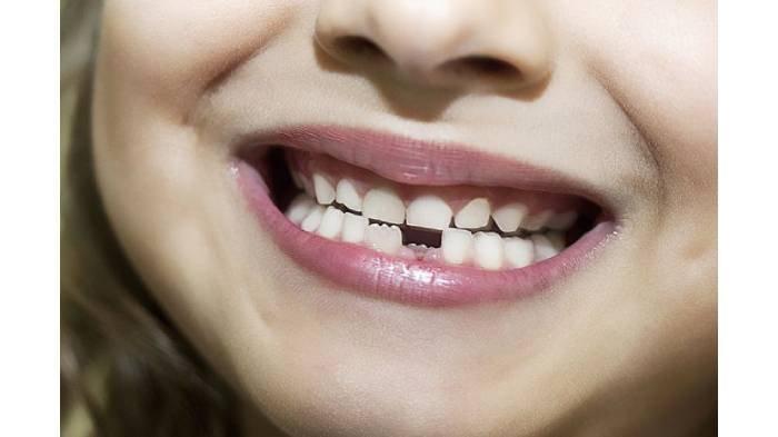 Mimpi Gigi Copot, Kabar Baik atau Sedih? Ini Penjelasannya