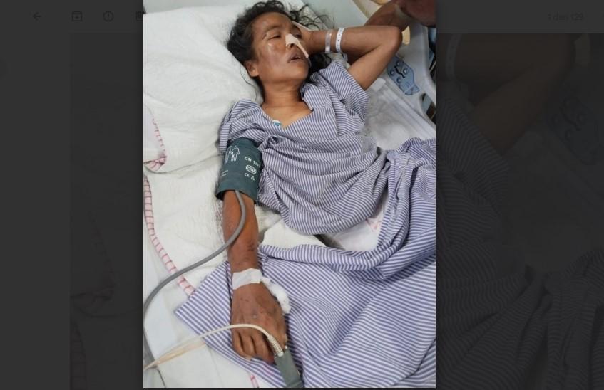 TKW Kerinci Jambi Dianiaya di Malaysia, Keluarga Butuh Bantuan Karena Tak Sanggup Biayai Pengobatan