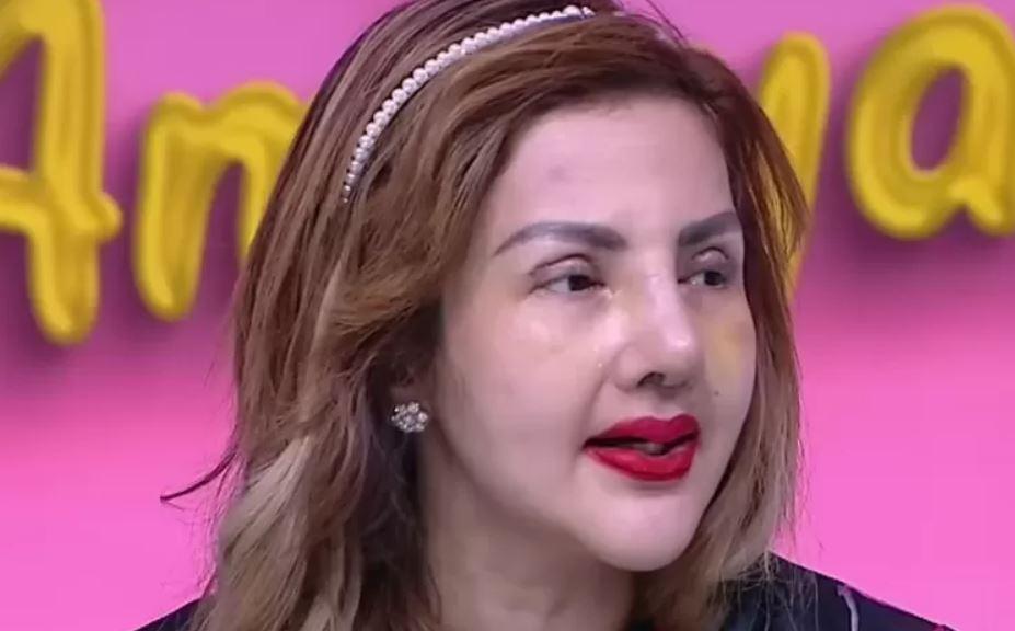 Kondisi-Wajah-Barbie-Kumalasari-8-Kali-Oplas-Disindir-Ruben-Onsu-Ngaku-Mau-Tiru-Kylie-Jenner.jpg