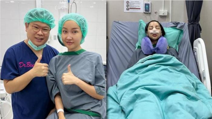 Memprihatinkan Wajah Baru Lucinta Luna Usai Oplas Terakhir, Warganet: Gak Ada yang Berubah bang