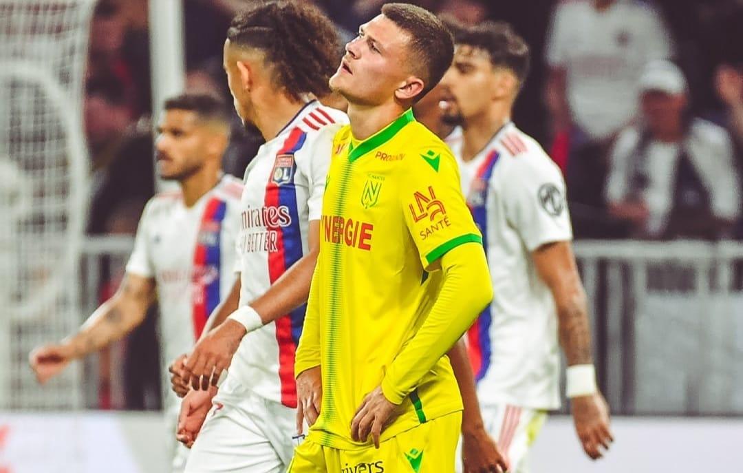 Prediksi Skor Strasbourg vs Nantes, Cek H2h dan Statistik Kedua Tim, Kick off 02.00 WIB