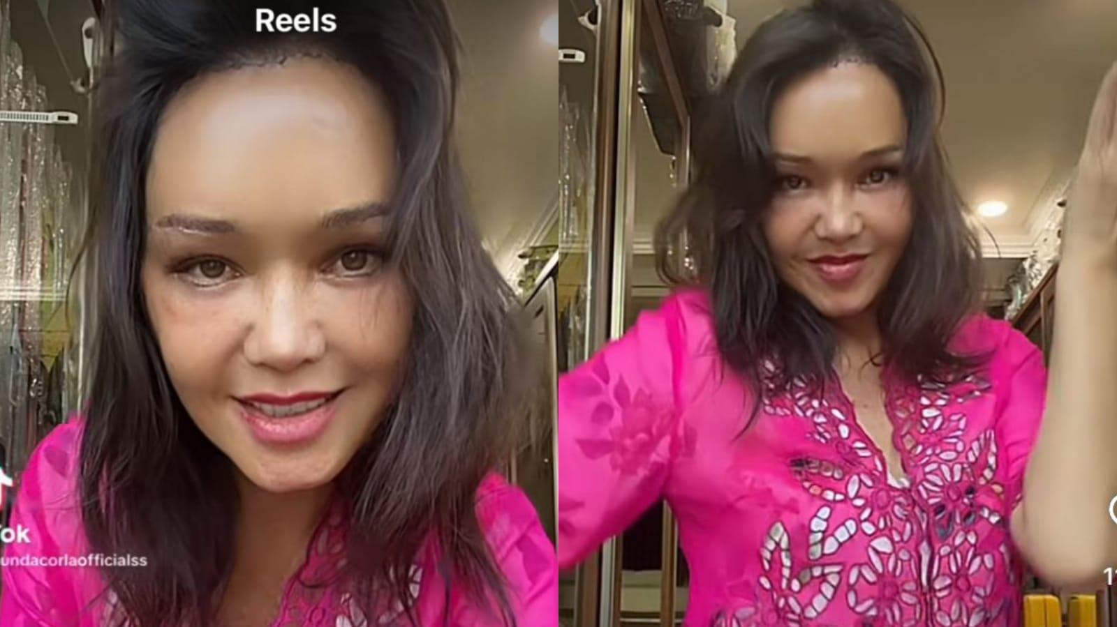 Wajah Bunda Corla Disorot usai Operasi Plastik Rp 1,5 Miliar: Mendingan yang Dulu!