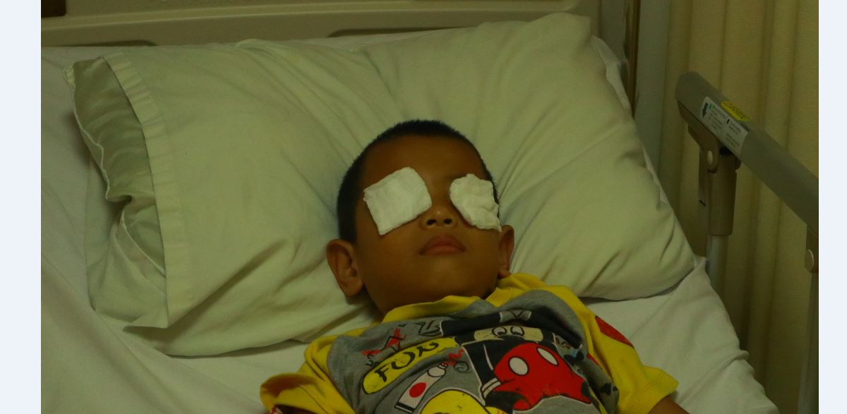 Ini Nama Penyakit Mata yang Diderita Fikri, Bocah dari Tanjabtim yang Tak Boleh Terpapar Asap
