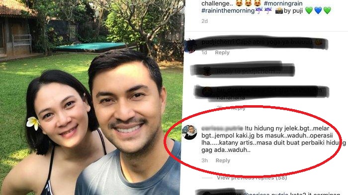 Tindakan Anjasmara Laporkan Netizen yang Hina Istrinya Dikomentari Berbagai Artis