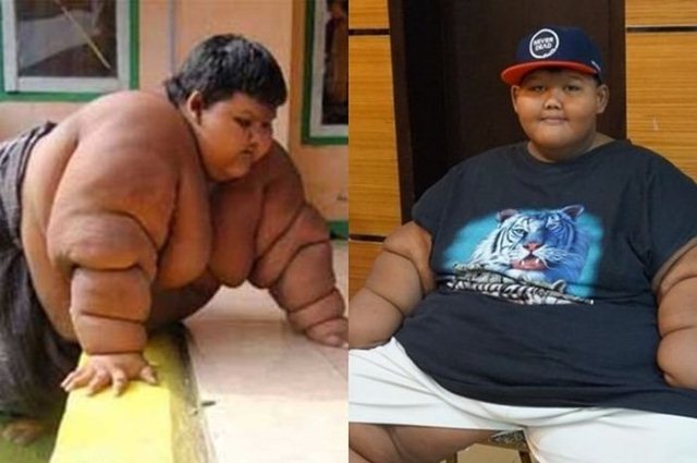 Ingat Arya Permana? Dulu Dijuluki Bocah Terberat di Dunia, Kini Berubah Usai Bertemu dengan Ade Rai