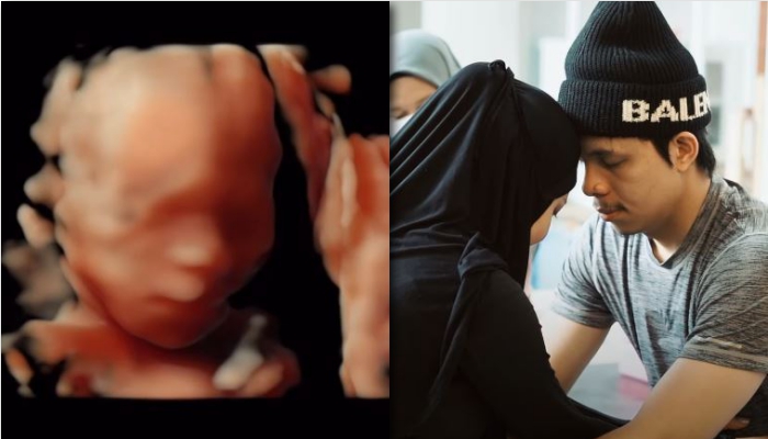 Kondisi Bayi Aurel Saat USG Diperlihatkan Atta Halilintar, Reaksi Mertua Disorot: Ya Allah