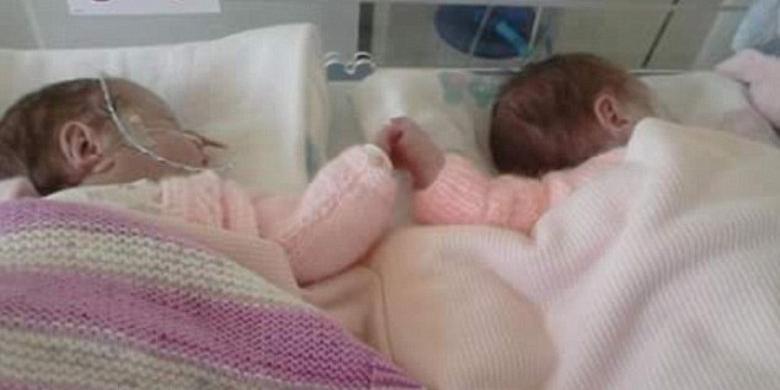 Menakjubkan, Dua Bayi Prematur Ini Selalu Berpegangan Tangan di Inkubator