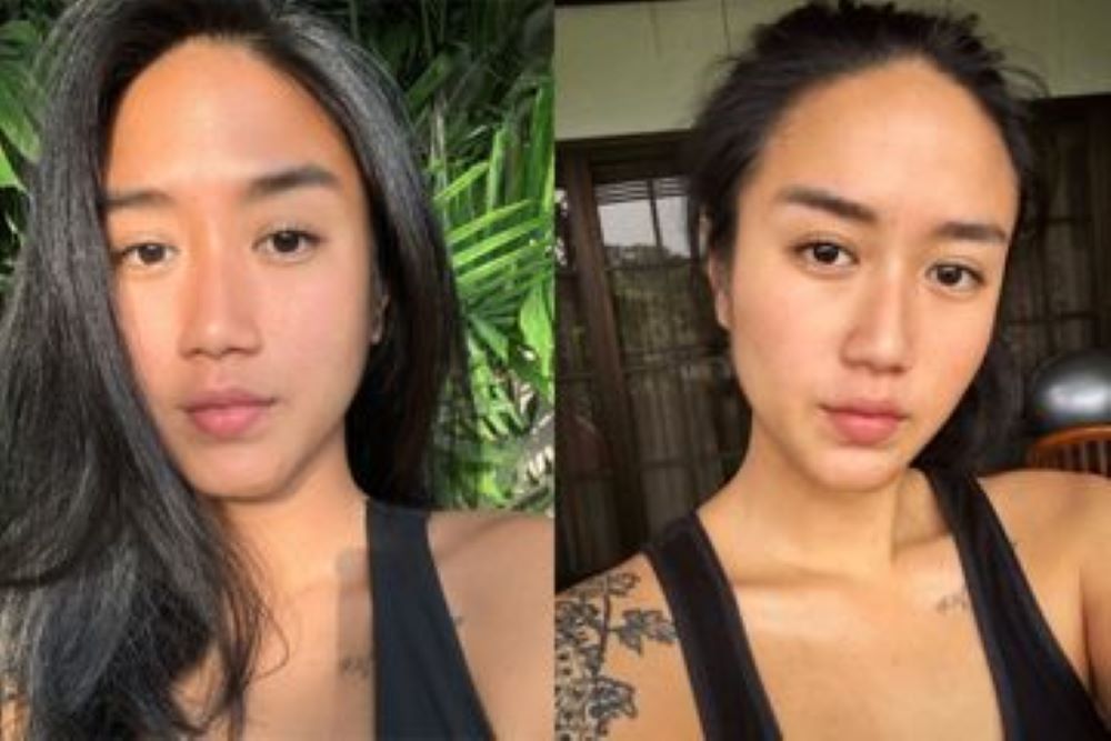 Chef Renatta Tunjukan Luka Bakar, Deddy Corbuzier : Wanita yang Menakjubkan