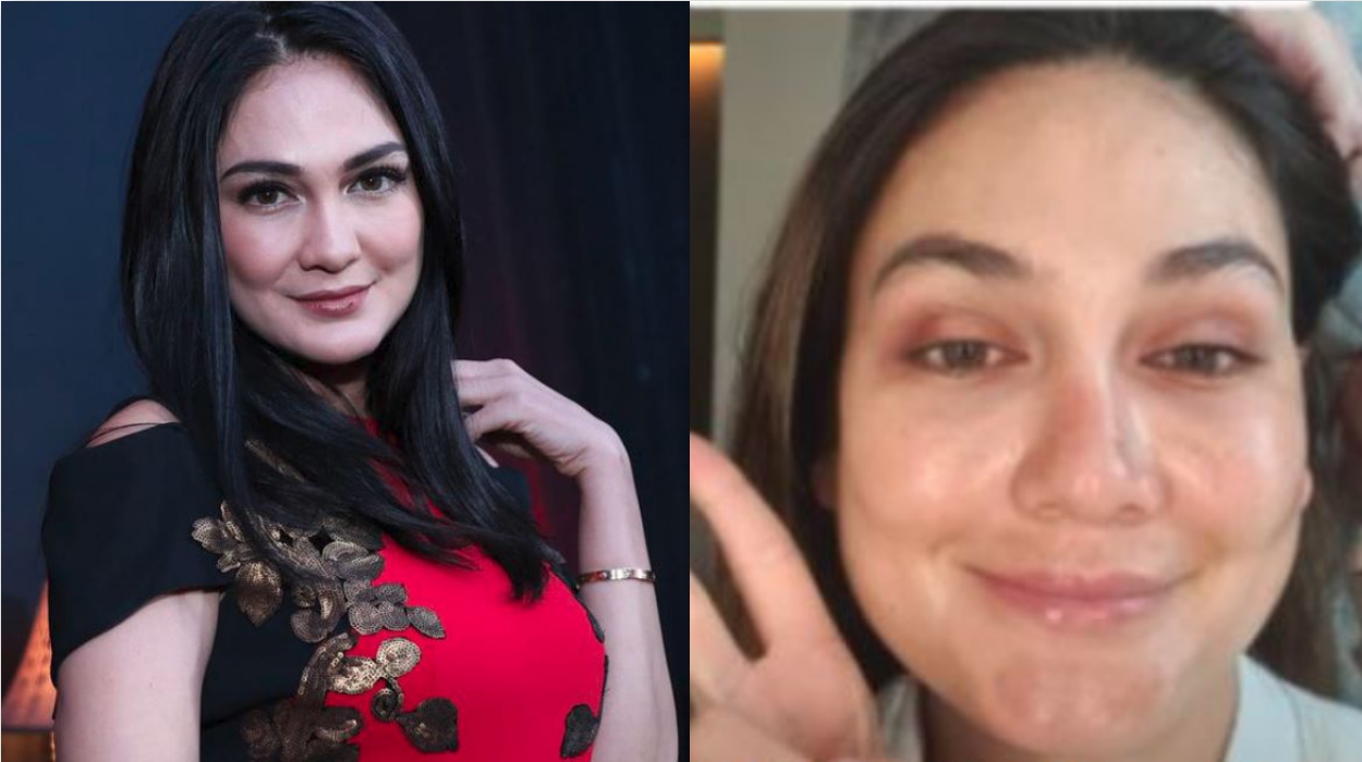 Wajah Polos Luna Maya Tanpa Makeup Mendadak Jadi Sorotan, Kok Bisa Banyak Flek Hitam Gitu?