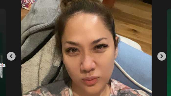 Keadaan Bunga Citra Lestari Membaik Pada Isolasi Hari Kedelapan, Tapi Ia Masih Keluhkan Hidung