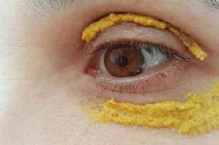 Rutin Oleskan Masker Kunyit di Bawah Mata Selama 10 Menit, Hasilnya Mengejutkan