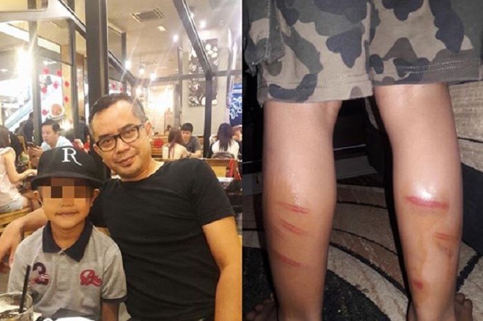 Bapak Anak Ini Menangis Setelah Tau Apa yang Terjadi, Mengerikan