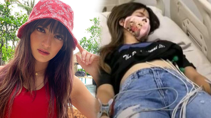 NIA RAMADHANI Drop Lagi! Napasnya Tersengal-sengal Naiki Tangga, Padahal Baru Pulang Berobat dari AS
