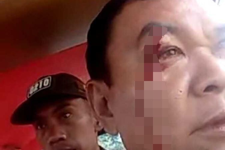 Kapolsek Pahae Jae dan 6 Personelnya Luka-luka, Bentrokan Oknum TNI dan Polisi di Silangkitang