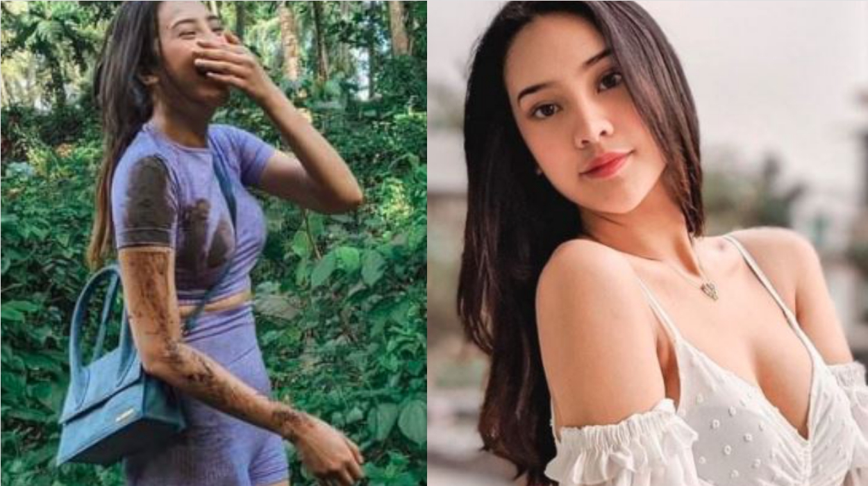 Anya Geraldine Trending Topic Gegara Tubuhnya yang Kotor Terluka, Gading Marten Kok Beraksi Begini!