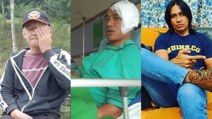 Awal Mula Munculnya Kanker Otak Agung Hercules hingga Meninggal Dunia, Ini Keinginan Terakhirnya