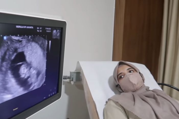 Tengah Hamil Muda, Zaskia Sungkar Dapat Saran dari Dokter Kandungan Untuk Minum Air Putih yang Cukup