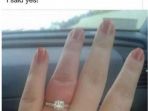 03112017_cincin_bengkak_20171103_165001.jpg