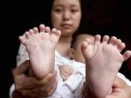 18052016-bayi-jari-banyak_20160518_121528.jpg
