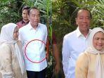 20250624-Jokowi-kata-Dokter-Tifa-sakit-auto-imun-agresif.jpg