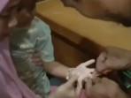 Cincin Tak Bisa Lepas dari Jari Zahra, Orang Tua Minta Bantuan Damkar Tebo Jambi