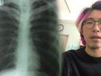 foto-rontgen-paru-paru-dr-tirta-yang-membuatnya-tobat-sempat-dikira-terinfeksi-covid-19.jpg