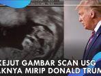 foto-usg-mirip-wajah-donald-trump-232.jpg