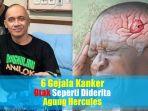 video-ketahui-6-gejala-kanker-otak-yang-harus-diwaspadai-seperti-yang-diderita-agung-hercules.jpg
