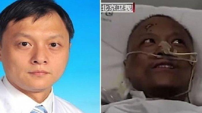 Langka, 2 Dokter Positif Corona di Wuhan China Alami Kulit Menghitam