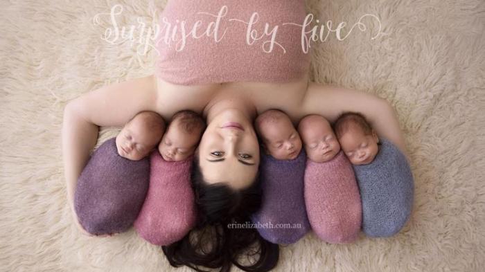 Kisah Ibu Yang Melahirkan Anak Kembar Lima, Sehari Ganti Popok 350 Kali