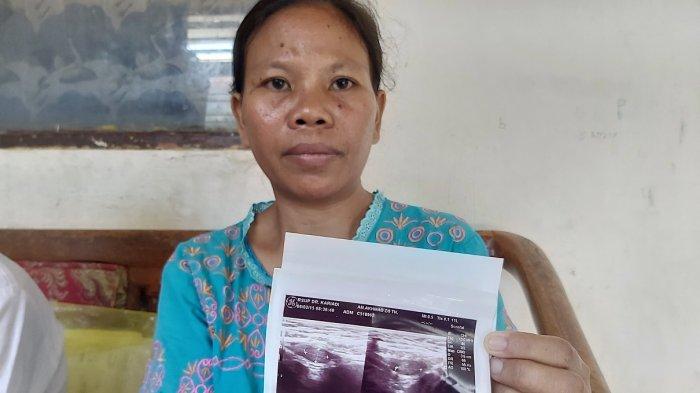 Kisah Bocah Asal Tegal Lahir dengan Kelamin Ganda, Butuh Biaya Hidup Jika Operasi di Semarang