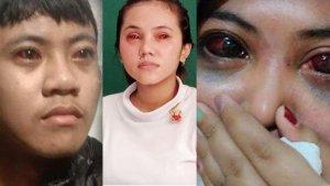 raffi-naswa-dan-diby-para-korban-gas-air-mata-kadaluarsa-di-tragedi-kanjuruhan.jpg