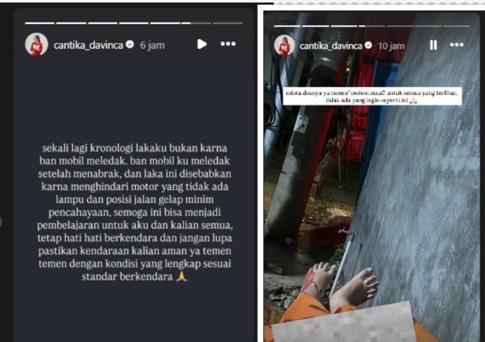 KECELAKAAN : Unggahan Instagram @cantika_davinca pada Jumat (3/10/2025) : Penyanyi Cantika Davinca membagikan kondisi dirinya setelah mengalami kecelakaan