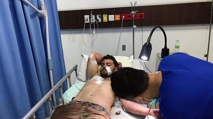 Viral Video Bule Ngamuk di Bali, Tendang Pengendara Motor dan Membanting Seorang Warga