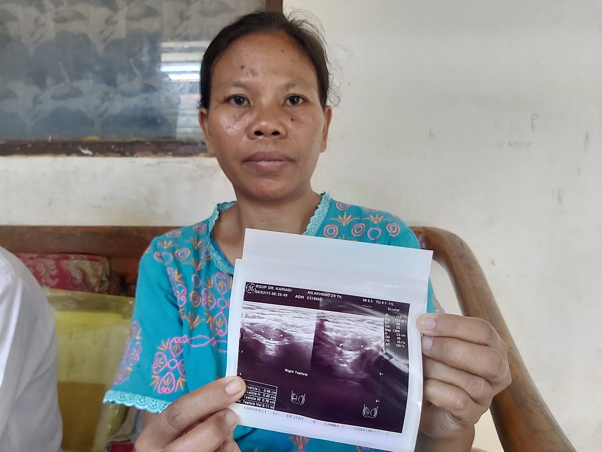 Kisah Bocah Asal Tegal Lahir dengan Kelamin Ganda, Butuh Biaya Hidup Jika Operasi di Semarang