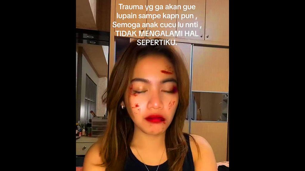 seleb-tiktok-andin-unggah-foto-filter-muka-lebam.jpg