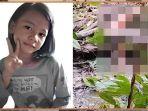 3-Luka-Mencurigakan-di-Mayat-Amel-Setelah-13-Hari-Hilang-Rambut-Tiba-tiba-Botak.jpg